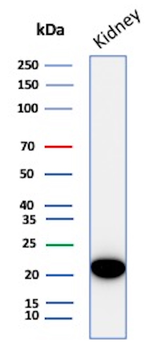 Crystallin Alpha B Antibody