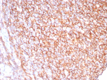 Recombinant CD21 (Mature B-Cell & Follicular Dendritic Cell Marker) Antibody