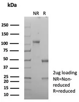 Recombinant CD21 (Mature B-Cell & Follicular Dendritic Cell Marker) Antibody