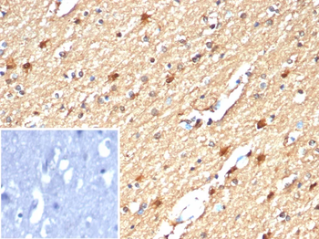 Creatine Phosphokinase-BB (CK-BB) Antibody