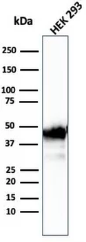 Creatine Phosphokinase-BB (CK-BB) Antibody
