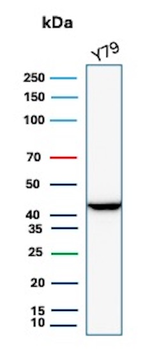 Creatine Phosphokinase-BB (CK-BB) Antibody