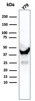 Creatine Phosphokinase-BB (CK-BB) Antibody