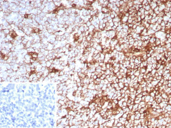 Recombinant CD63 (Late Endosomes Marker) Antibody