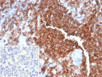 CD39 Antibody