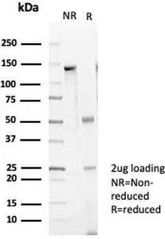 CD39 Antibody
