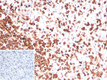 Recombinant CD3e (T-Cell Marker) Antibody