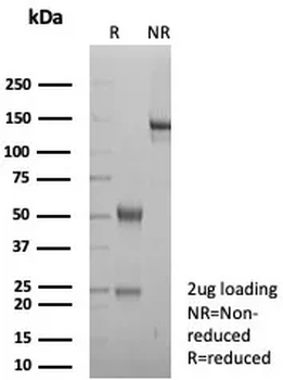 Recombinant CD3e (T-Cell Marker) Antibody