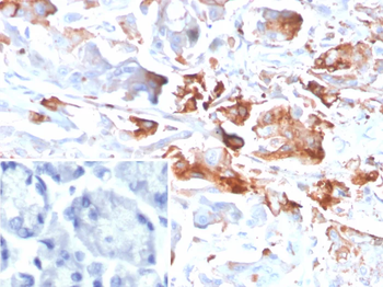CEACAM1 Antibody