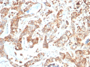 CD269 / TNFRSF17 / BCMA (B-Cell Maturation Protein) Antibody