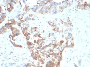 CD269 / TNFRSF17 / BCMA (B-Cell Maturation Protein) Antibody