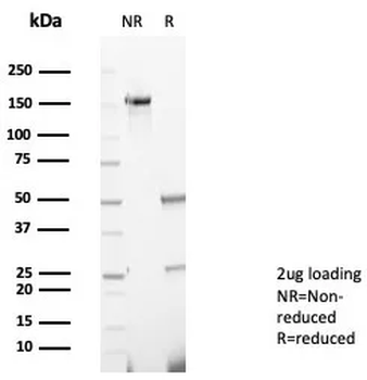 CD269 / TNFRSF17 / BCMA (B-Cell Maturation Protein) Antibody
