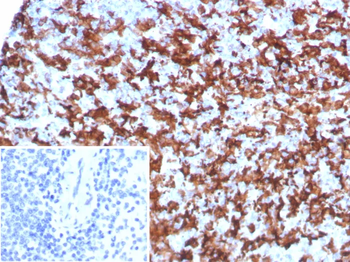 Recombinant AIF1 / Iba1 (Microglia Marker) Antibody