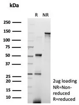 Recombinant AIF1 / Iba1 (Microglia Marker) Antibody