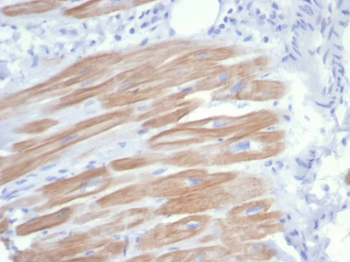 ACTN2 Antibody