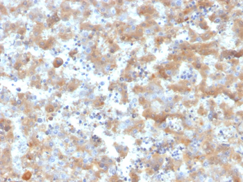 Alpha-2-Macroglobulin Antibody