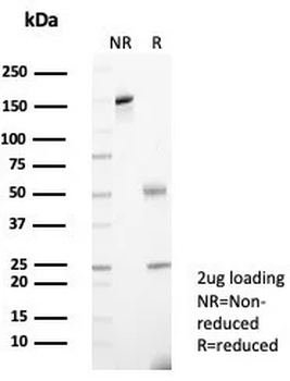 Alpha-2-Macroglobulin Antibody