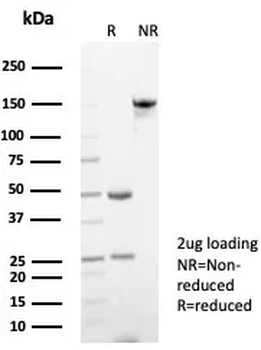 A2M Antibody
