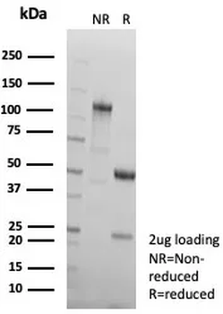 LRP1 Antibody