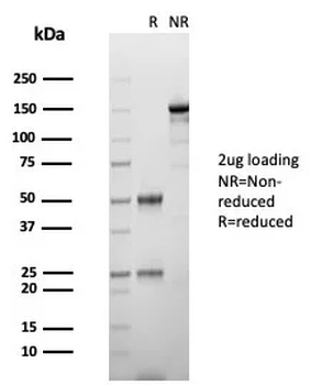 CGA Antibody