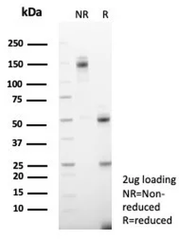 CGA Antibody