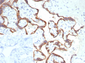 CGA Antibody