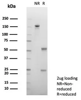 CGA Antibody