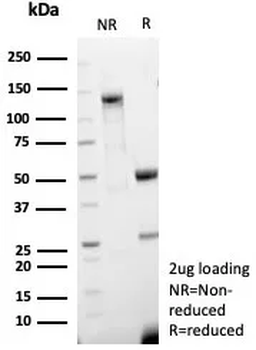 Recombinant CD63 (Late Endosomes Marker) Antibody