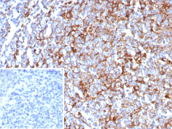 Recombinant CD63 (Late Endosomes Marker) Antibody