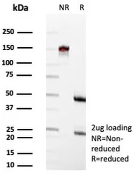 Recombinant CD63 (Late Endosomes Marker) Antibody