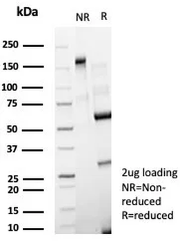Recombinant CD63 (Late Endosomes Marker) Antibody