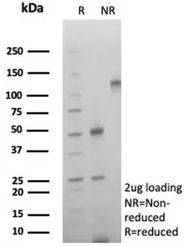 ENTPD1 Antibody