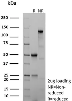Recombinant CD40 / TNFRSF5 / CD40L-Receptor Antibody