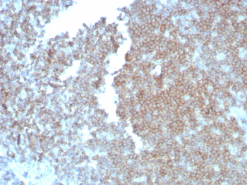 Recombinant CD27 (Tumor Necrosis Factor Receptor Superfamily 7) Antibody