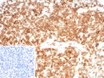 Recombinant CD27 (Tumor Necrosis Factor Receptor Superfamily 7) Antibody