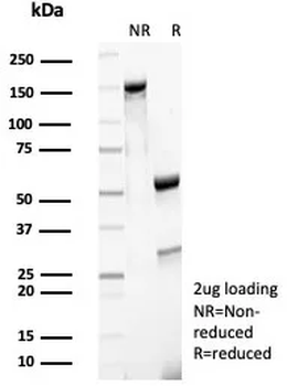 Recombinant CD27 (Tumor Necrosis Factor Receptor Superfamily 7) Antibody