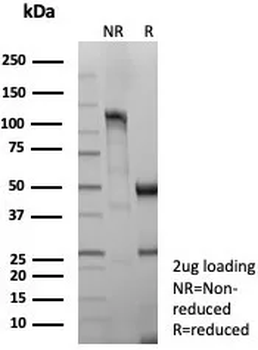 CD8A Antibody