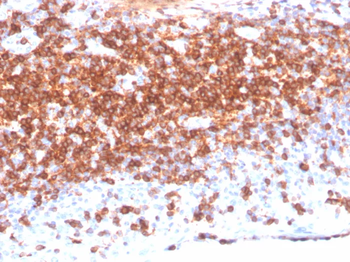 Recombinant CD7 (T-Cell Leukemia Marker) Antibody