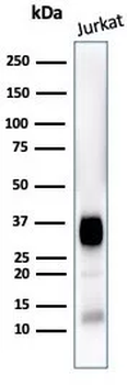 Recombinant CD7 (T-Cell Leukemia Marker) Antibody