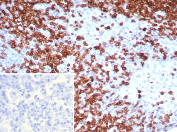 CD7 Antibody