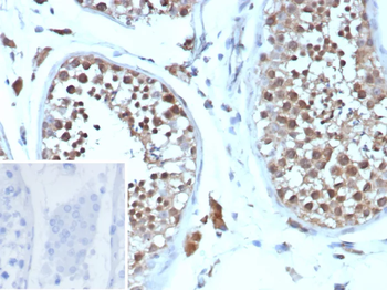 CCNB1 Antibody