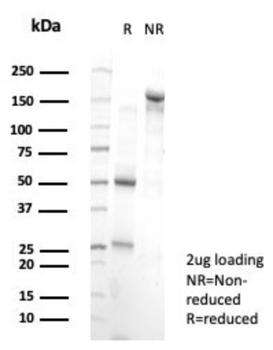 PRDM1 Antibody