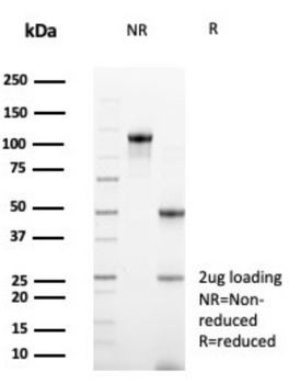 CD99 Antibody