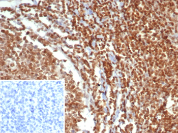 MGMT Antibody