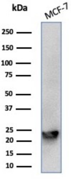 MGMT Antibody