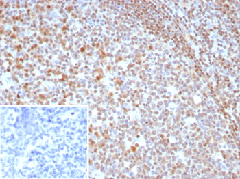 MGMT Antibody