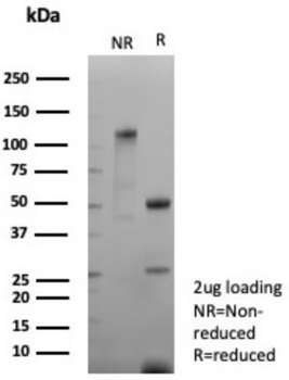 L1CAM Antibody