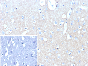 L1CAM Antibody