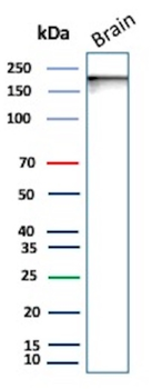 L1CAM Antibody