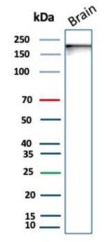 L1CAM Antibody